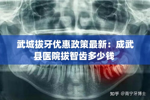 武城拔牙优惠政策最新：成武县医院拔智齿多少钱 