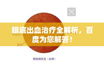 眼底出血治疗全解析，百度为您解答！