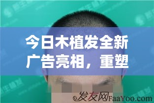 今日木植发全新广告亮相，重塑魅力自信新形象
