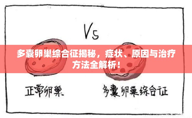 多囊卵巢综合征揭秘，症状、原因与治疗方法全解析！